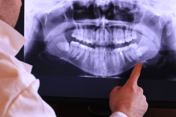 Best Emergency Treatment for Oral Infections in Bellefonte, PA